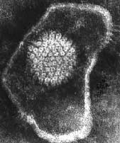 Virus de l'IBR